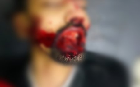 सैलाना रोड हादसा: पुलिस कार्रवाई की मांग, तेज रफ्तार कार चालक बने खतरा