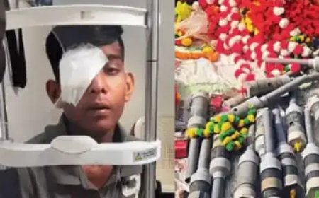 रतलाम में कार्बाइड गन (पटाखों) पर पूर्ण प्रतिबंध: आंखों की चोटों के बढ़ते मामलों के बाद प्रशासन हुआ सख्त