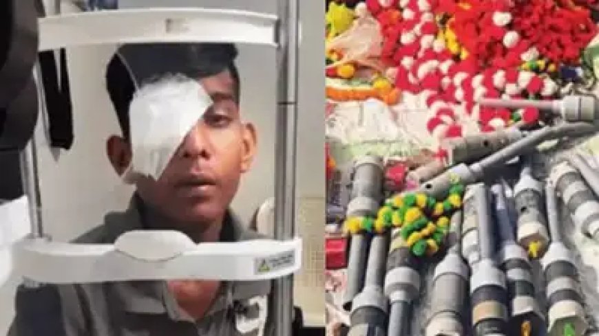 रतलाम में कार्बाइड गन (पटाखों) पर पूर्ण प्रतिबंध: आंखों की चोटों के बढ़ते मामलों के बाद प्रशासन हुआ सख्त