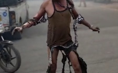 रतलाम के चांदनी चौक स्थित बंदूक दुकान में धमाका : आग लगने से तीन लोग झुलसे : पुलिस-प्रशासन मौके पर