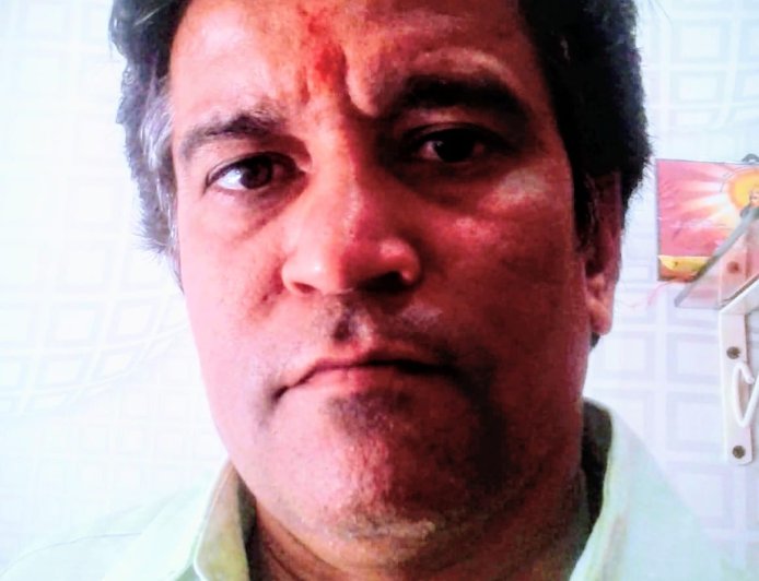 रतलाम में 35 लाख की जमीन ठगी: गोल्ड कॉम्प्लेक्स सौदे में कॉलोनाइजर मनीष सुराणा पर FIR : 62 करोड़ में तय हुआ था सौदा, फर्जी दस्तावेज दिखाकर बयाना हड़पने का आरोप